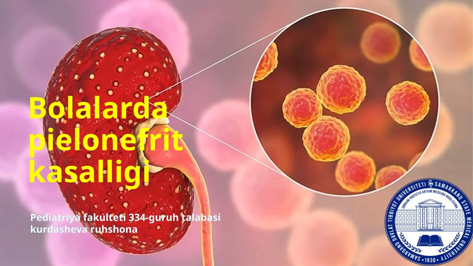 Bolalarda pielonefrit kasalligi