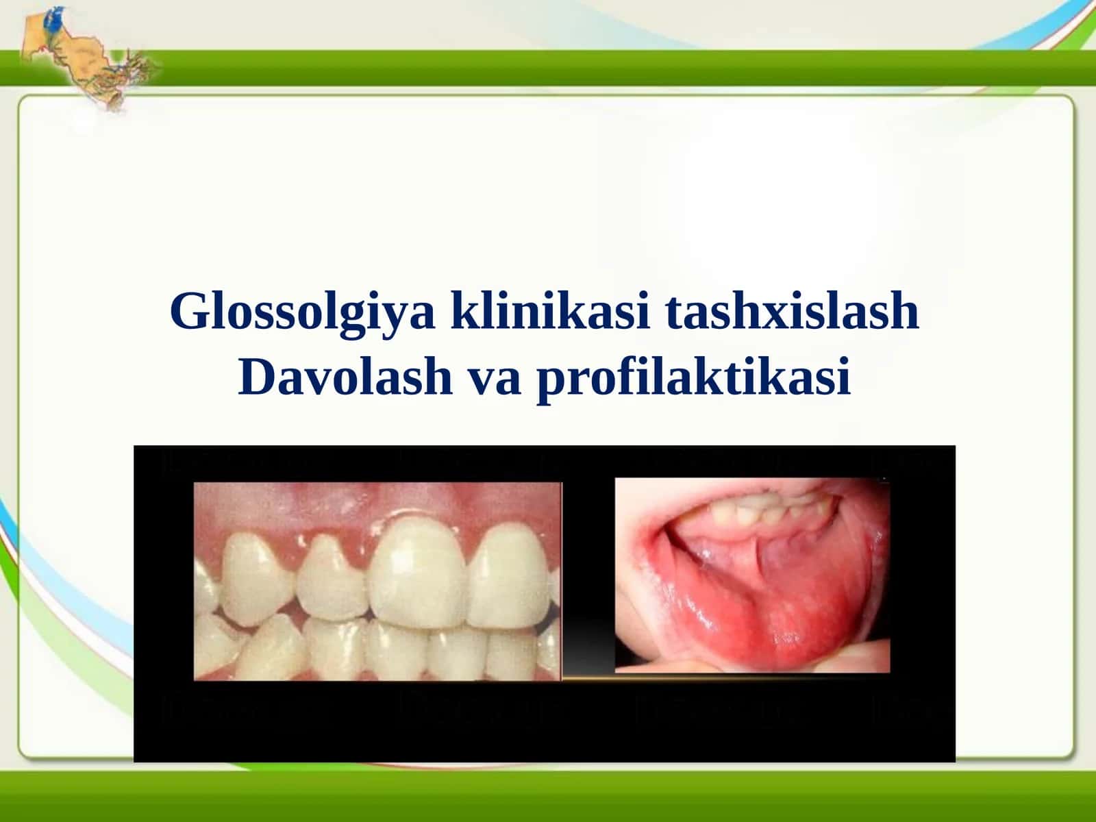 Glossalgiya tashxislash klinikasi.Davolash metodikasi.