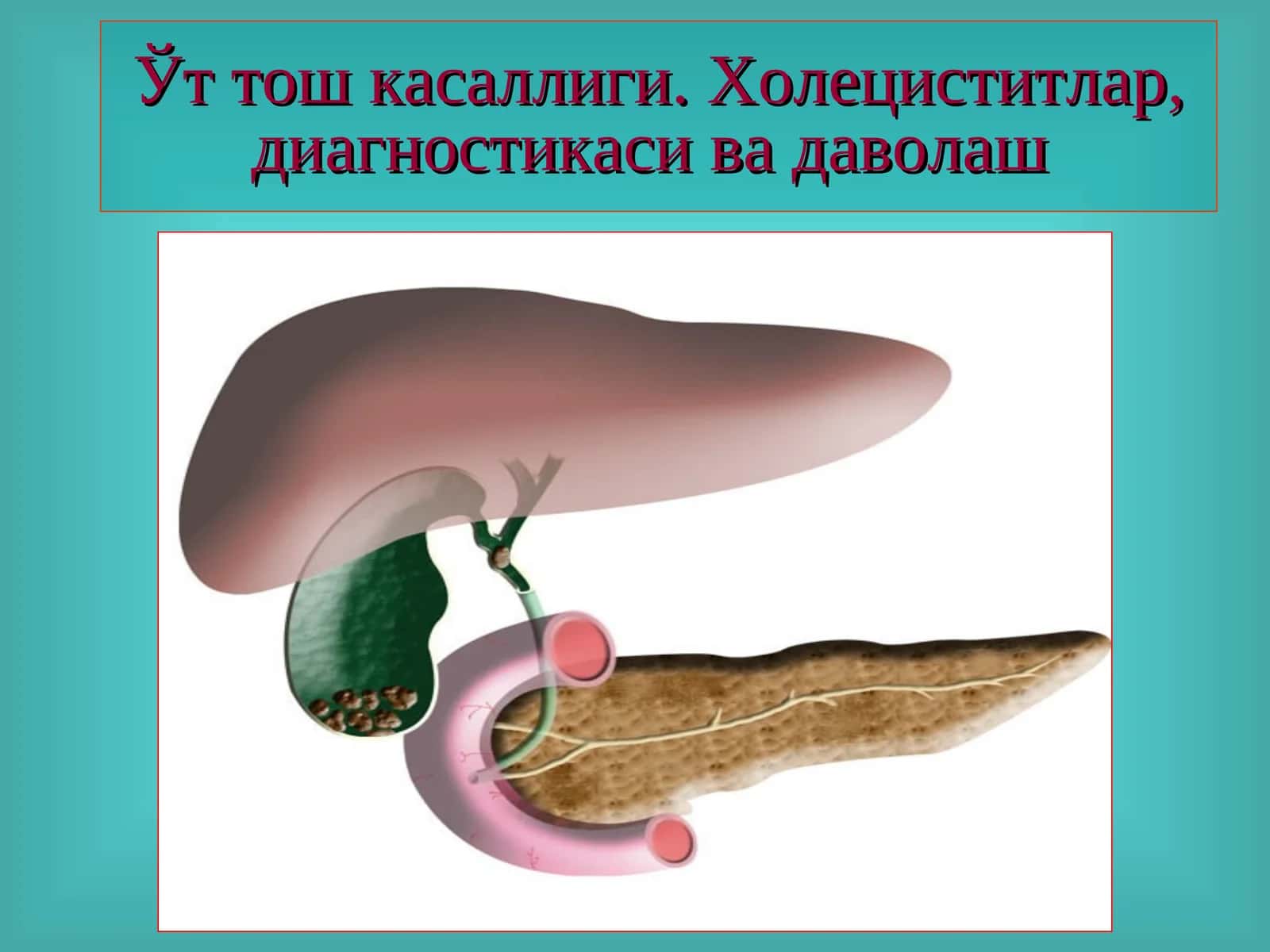 Ўт тош касаллиги.Холециститлар, диагностикаси ва даволаш