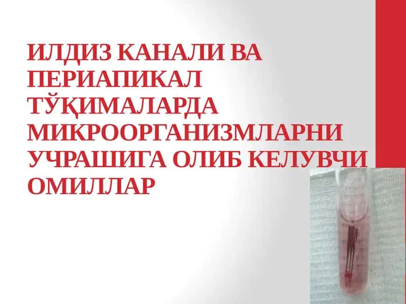 Илдиз канали ва периапикал тўқималарда микроорганизмларни учрашига олиб келувчи омиллар