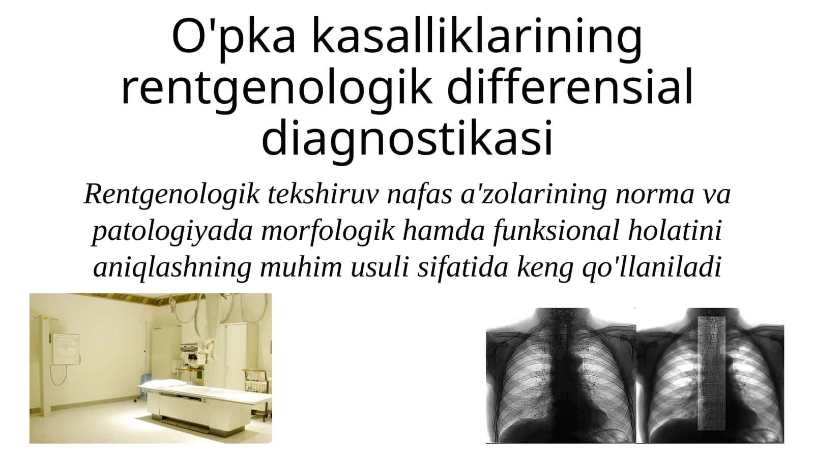 Rentgen bo'yicha differensial diagnostikasi