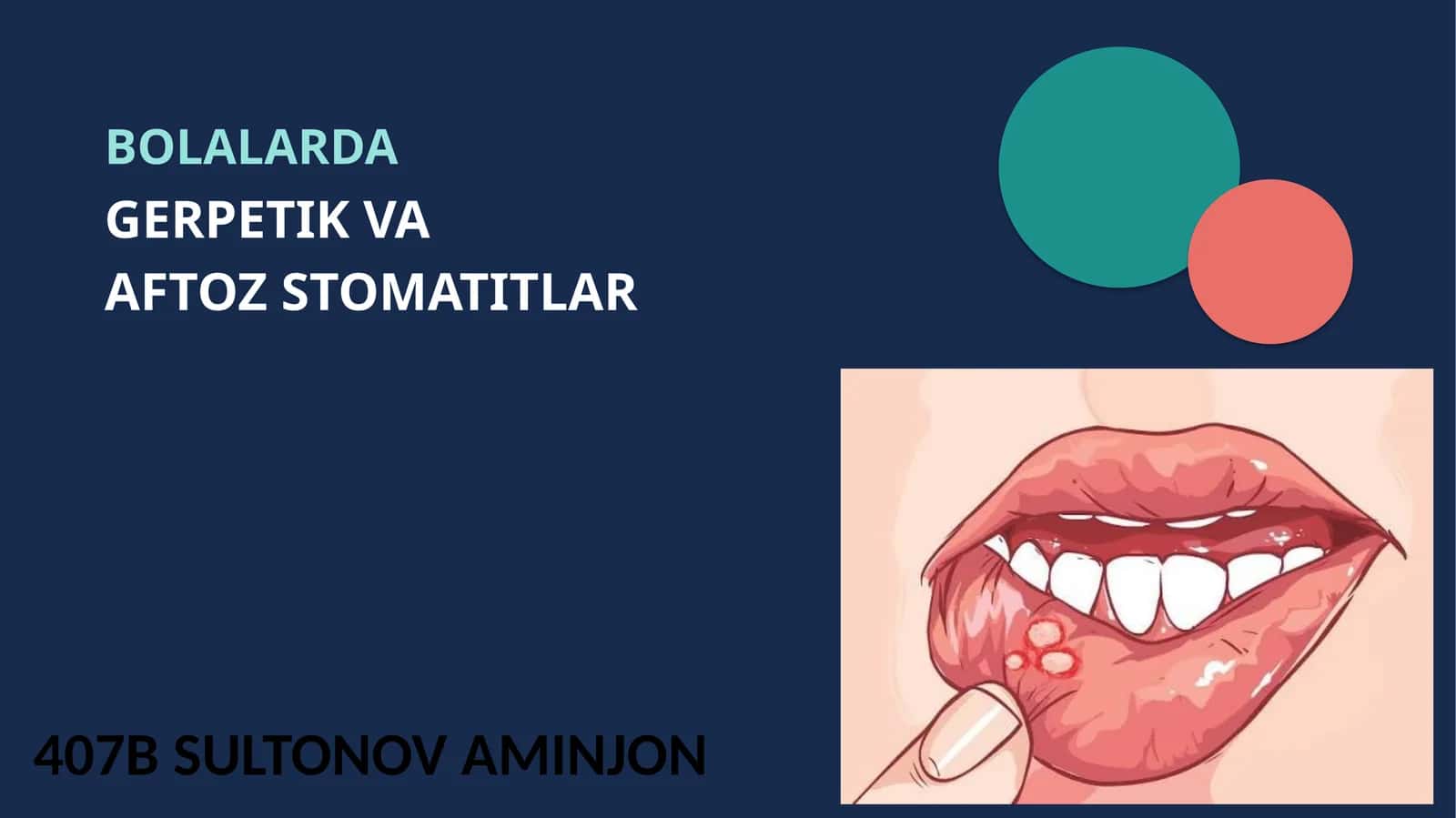 BOLALARDA GERPETIK VA AFTOZ STOMATITLAR