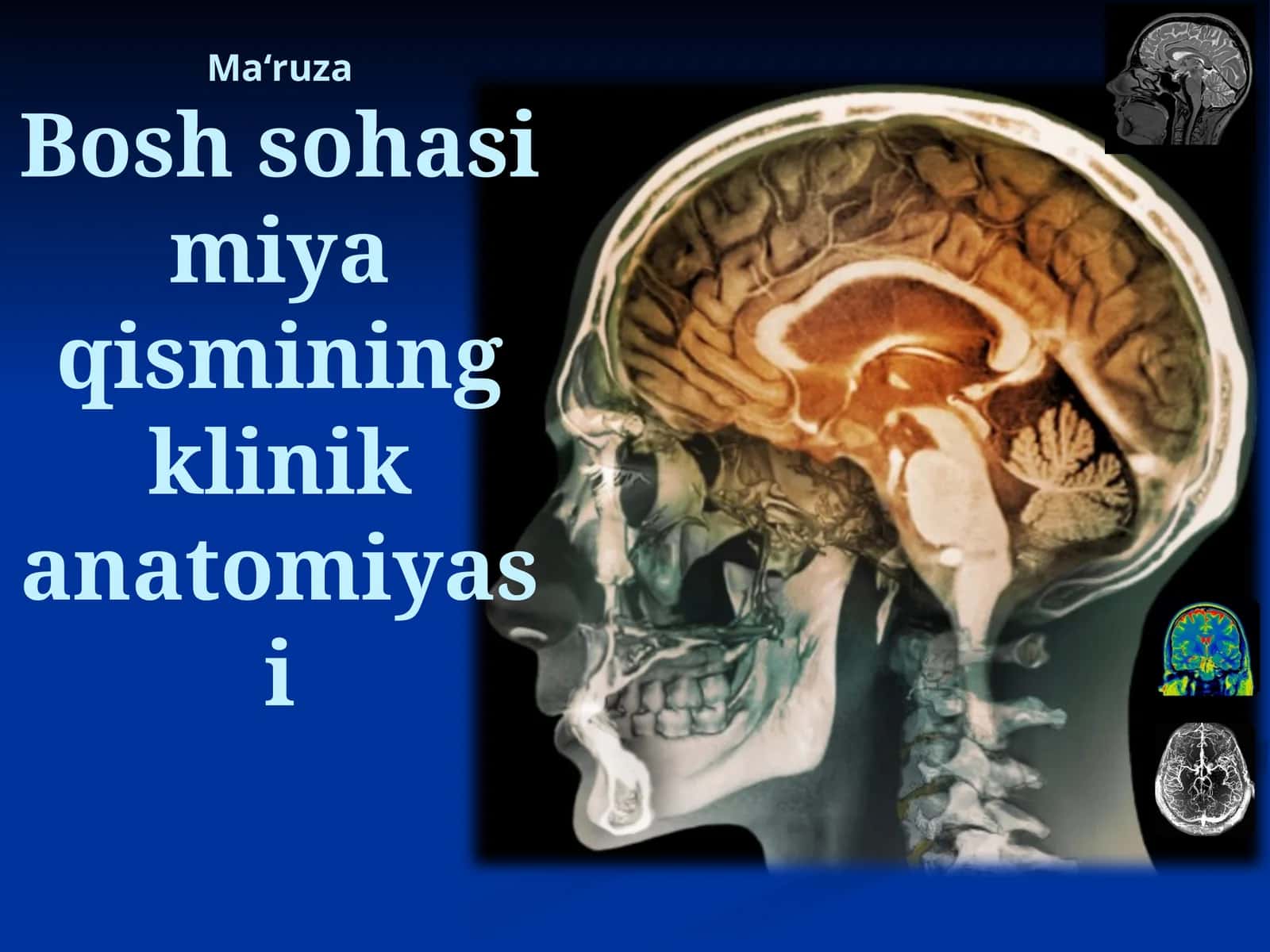 Maʻruza Bosh sohasi miya qismining klinika anatomiyasi