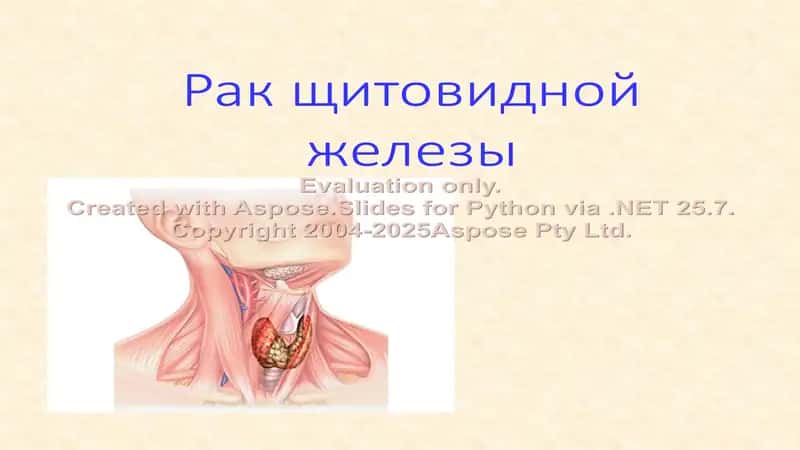 Рак щитовидной железы