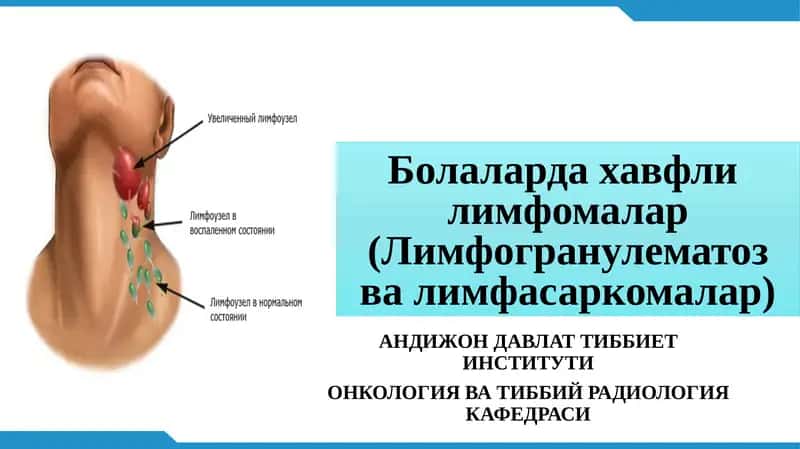 Болаларда хавфлилимфомалар(Лимфогранулематозвалимфасаркомалар)