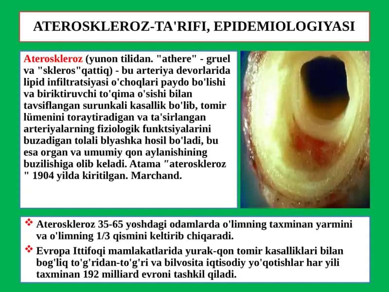 ATEROSKLEROZ-TA'RIFI, EPIDEMIOLOGIYASI