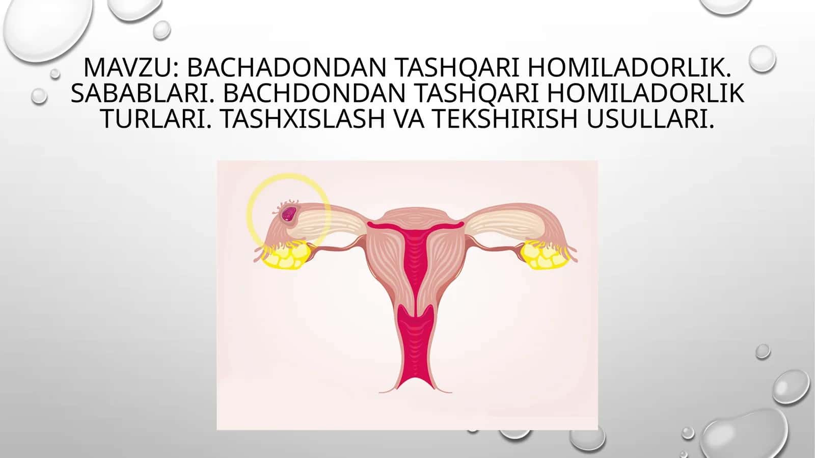 Bachadondan tashqari homiladorlik. Sabablari.Bachdondantashqari homiladorlik turlari.Tashxislashva tekshirish usullari