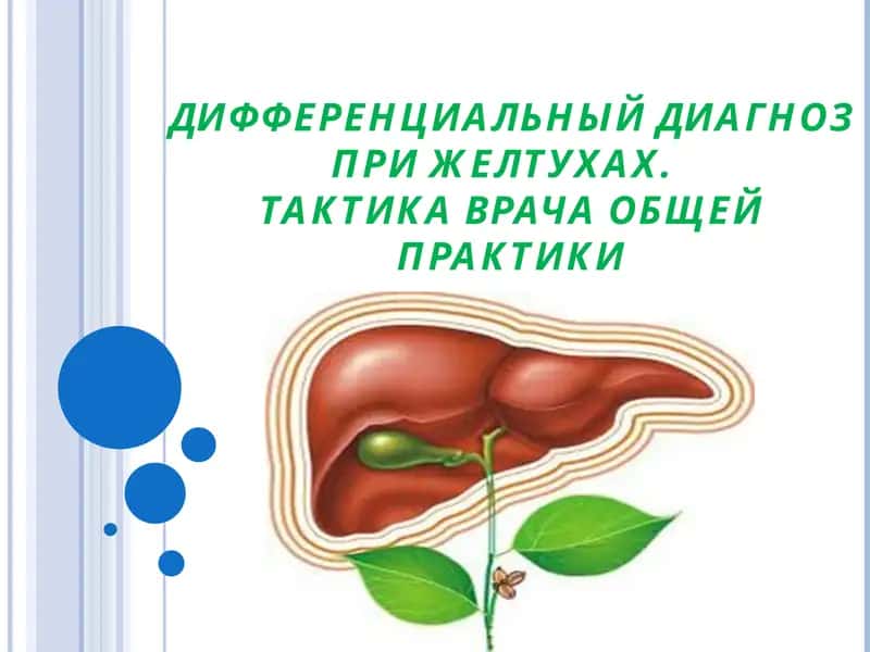 Дифференциальный диагноз при желтухах. Тактика врача общей практики