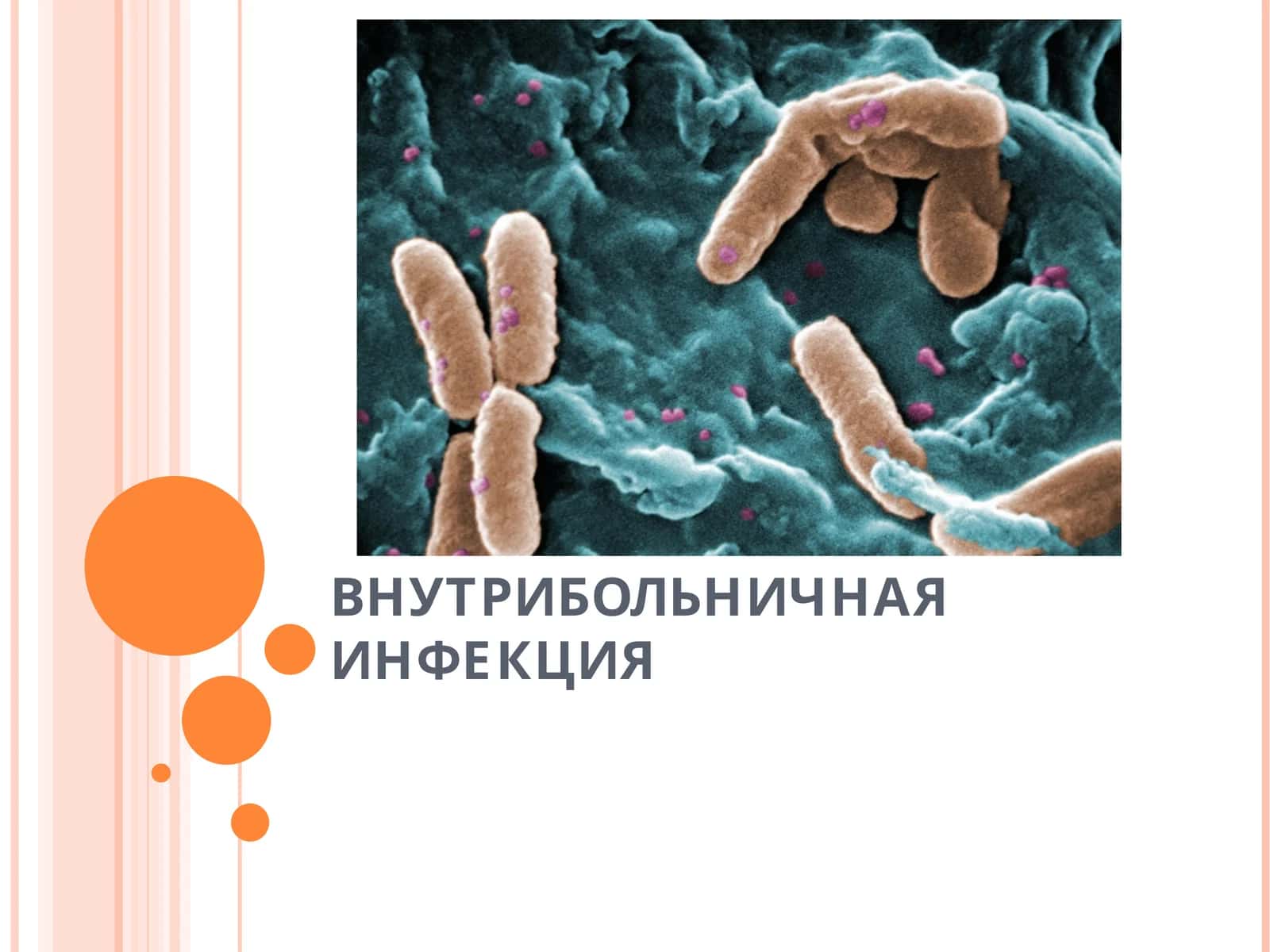 ВНУТРИБОЛЬНИЧНАЯ ИНФЕКЦИЯ