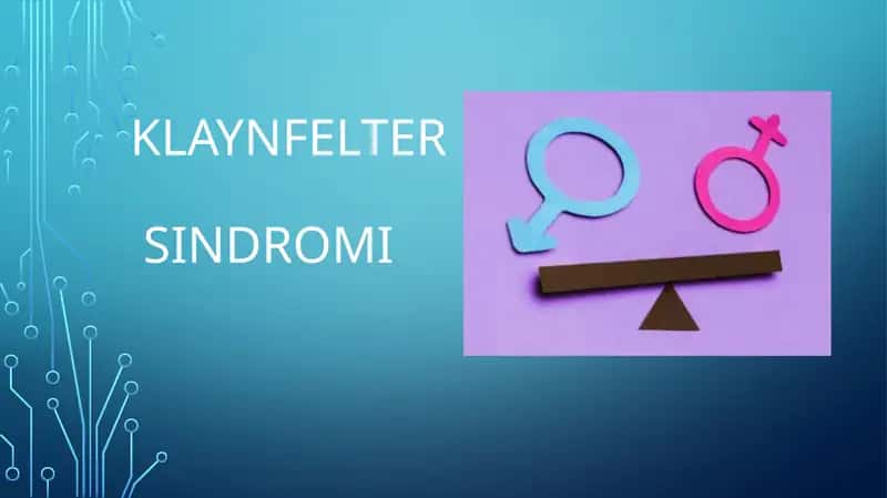 Klaynfelter sindromi xx xy xoromosoma