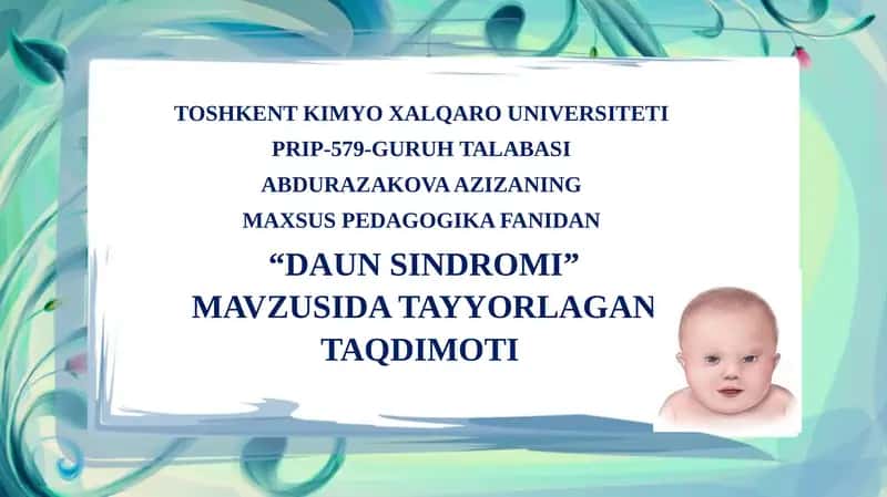 “DAUN SINDROMI” MAVZUSIDA TAYYORLAGAN TAQDIMOT
