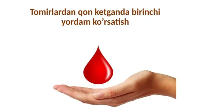 Arterial qonketish