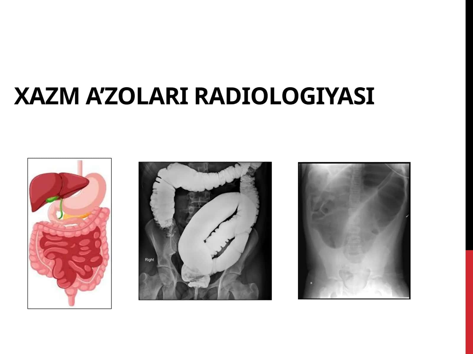 XAZM A’ZOLARI RADIOLOGIYASI