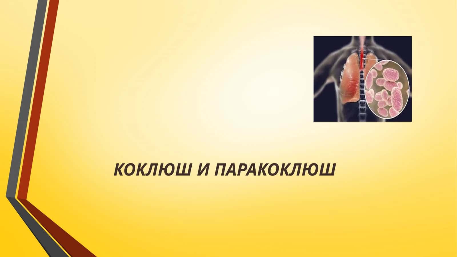 КОКЛЮШИ ПАРАКОКЛЮШ