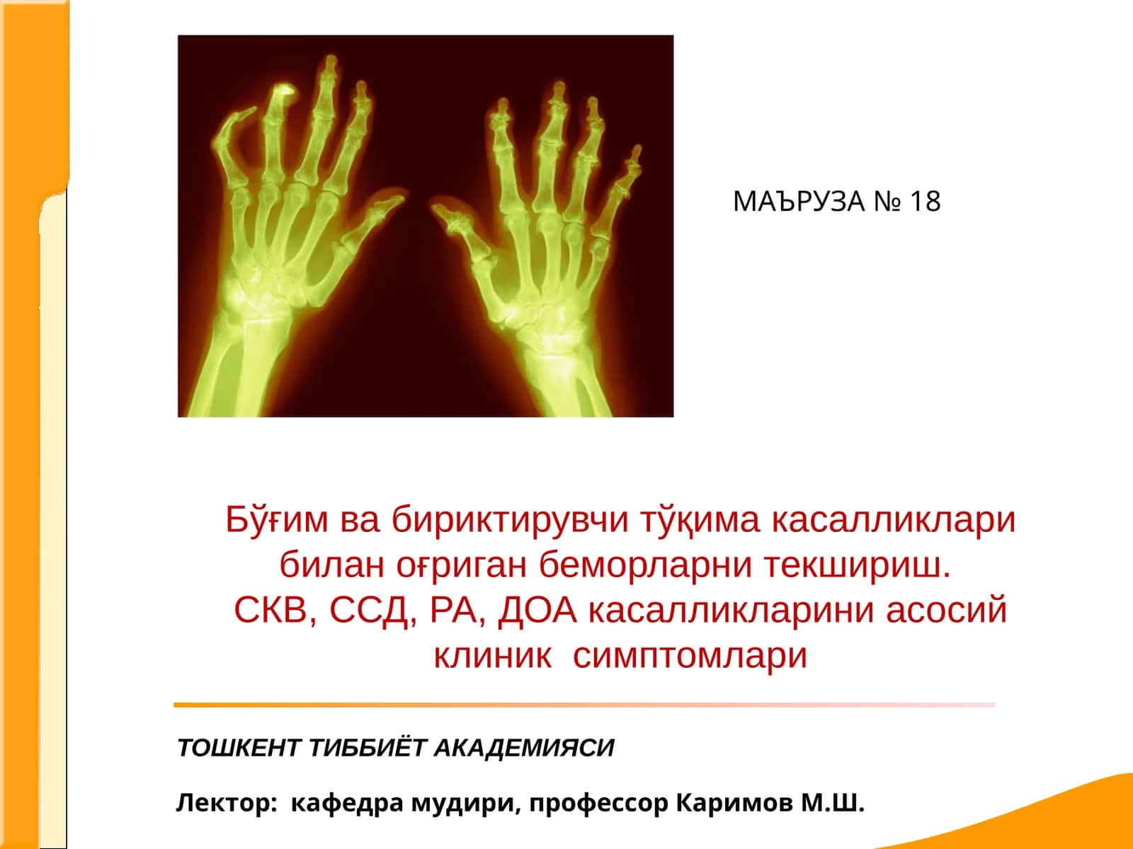 Системали кизил волчанка