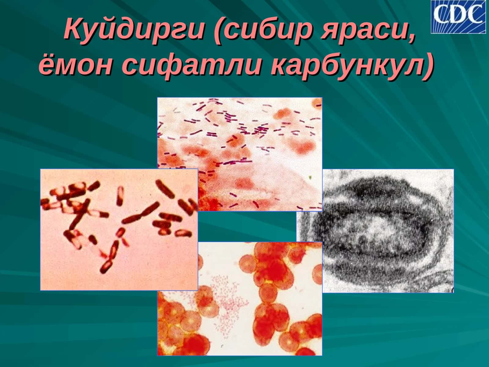 Куйдирги (сибир яраси, ёмон сифатли карбункул)