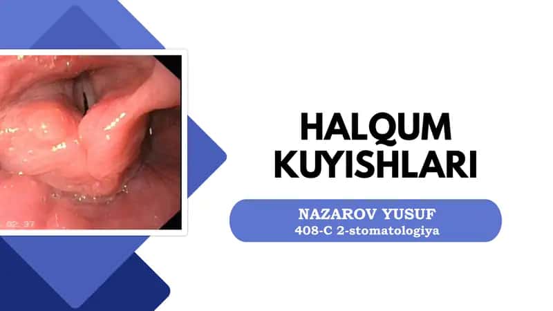 HALQUM KUYISHLARI