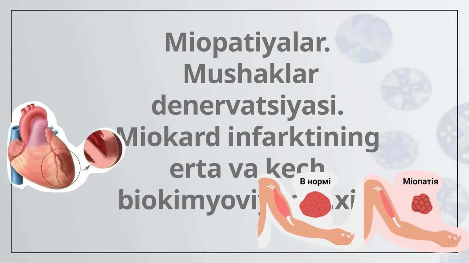 Miopatiyalar.Mushaklar denervatsiyasi. Miokard infarktining erta va kech biokimyoviy tashxisi