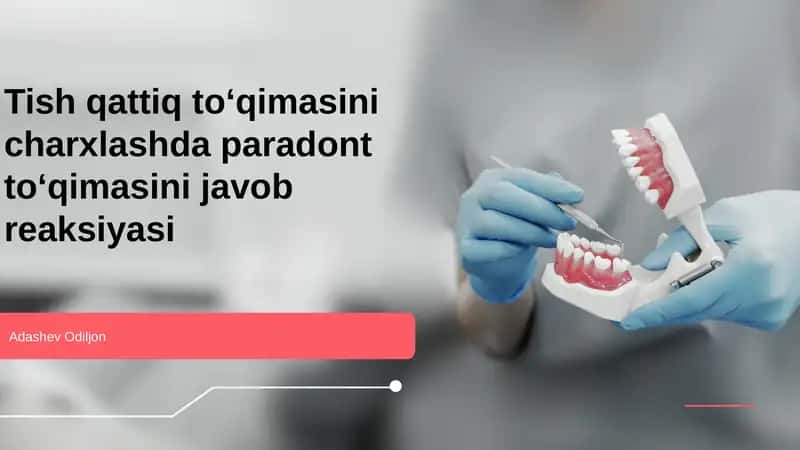Paradont toʻqimasi