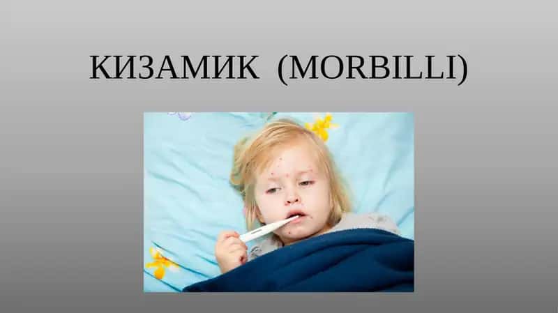 Қизамиқ (MORBILLI)