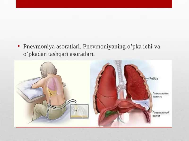 Pnevmoniya Asoratlari