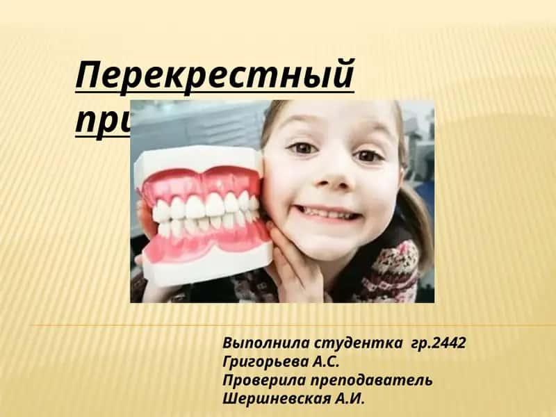 Перекрестный прикус