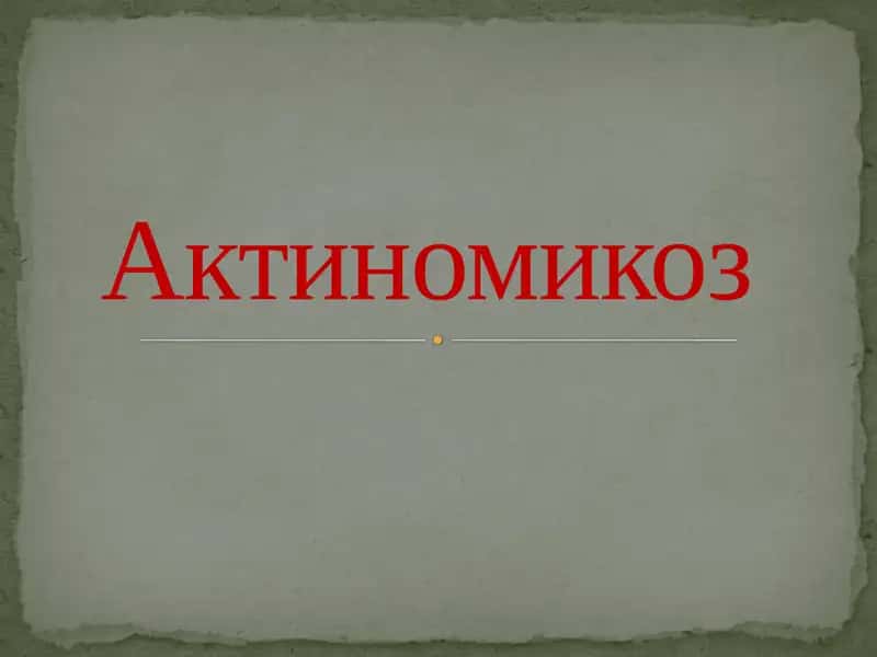 Актиномикоз