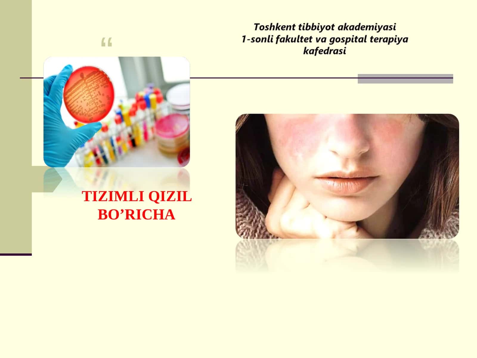 TIZIMLI QIZIL BO’RICHA BIRIKTIRUVCHI TO’QIMANING TIZIMLI KASALLIKLARI