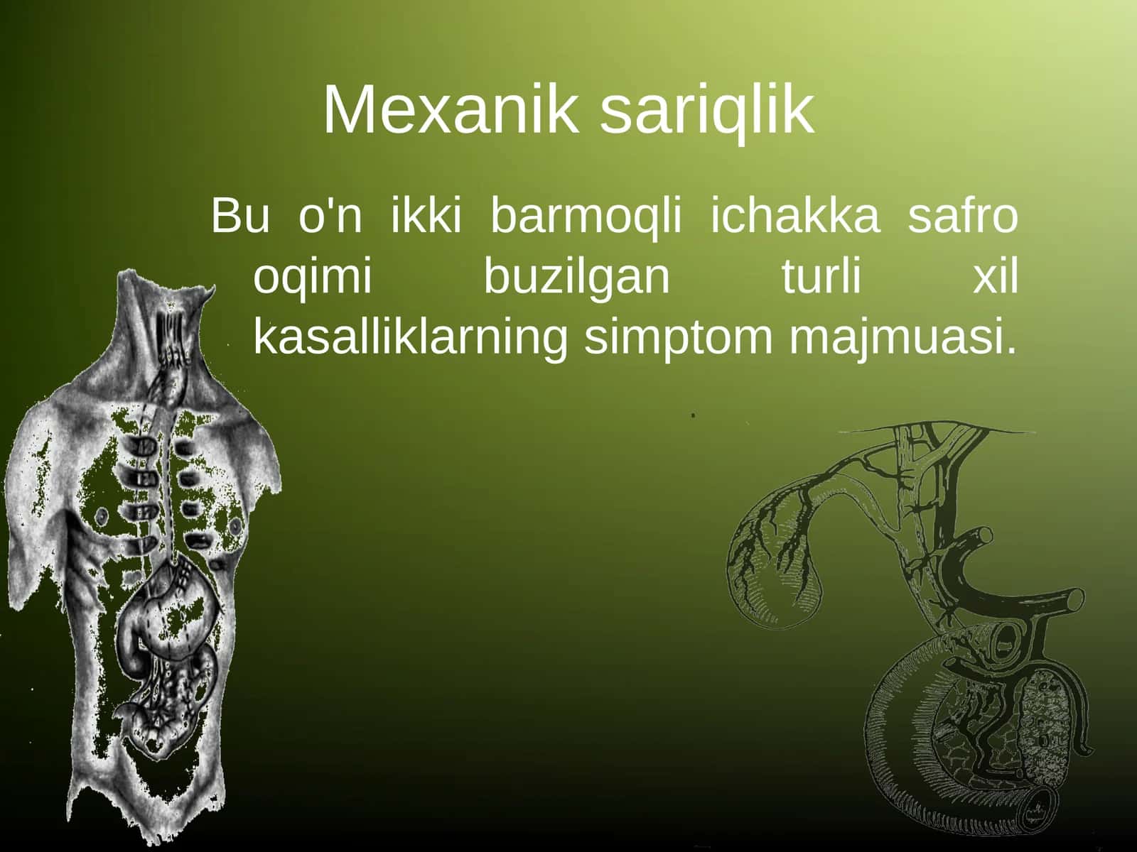 Mexanik sariqlik