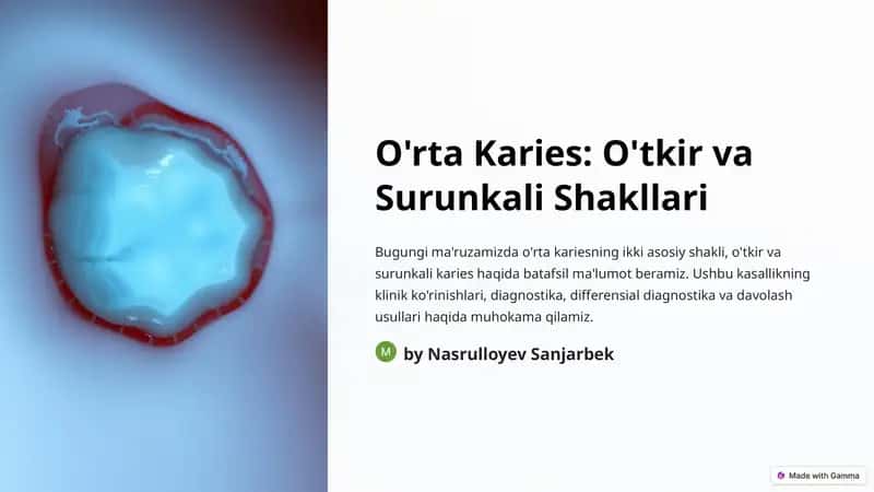 O'rta Karies: O'tkir va Surunkali Shakllari