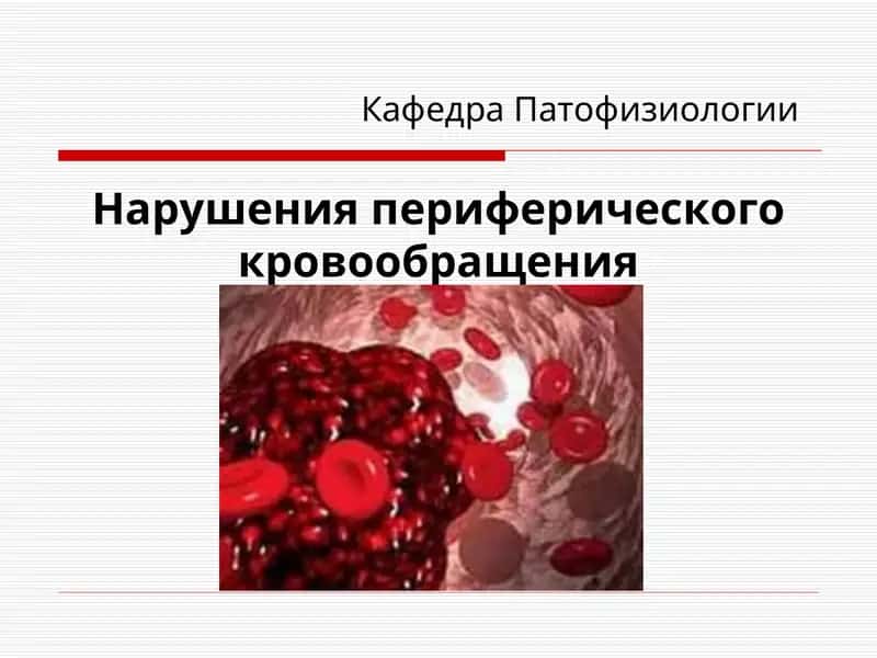 Нарушения периферического кровообращения
