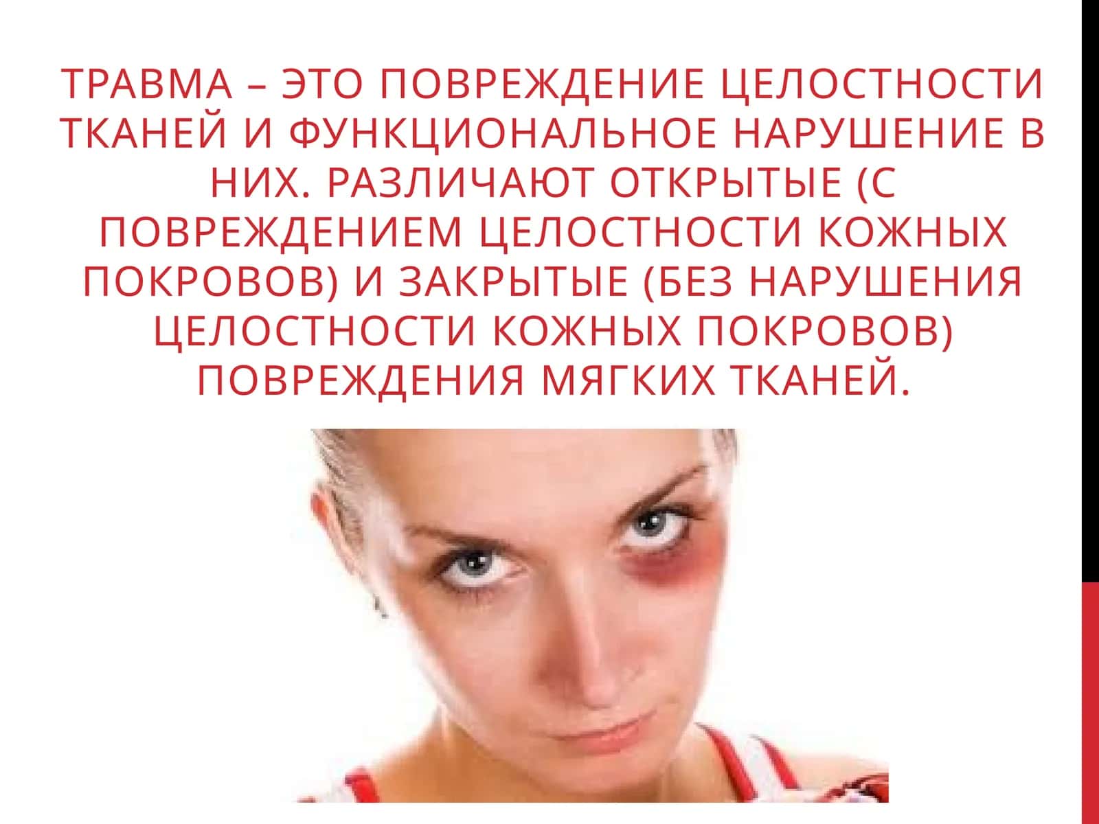 Травма