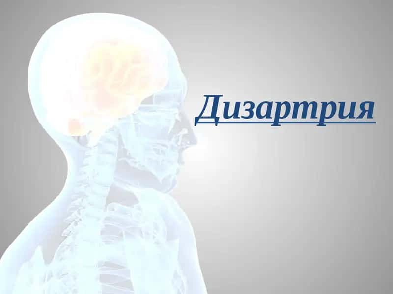 Дизартрия