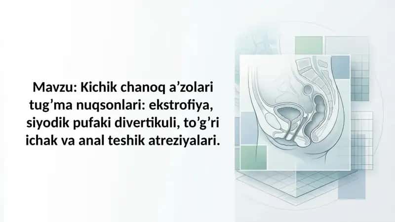 Kichik chanoq a'zolari tug'ma nuqsonlari ekstrofiya, siyodik pufaki divertikuli, to'g'ri ichak