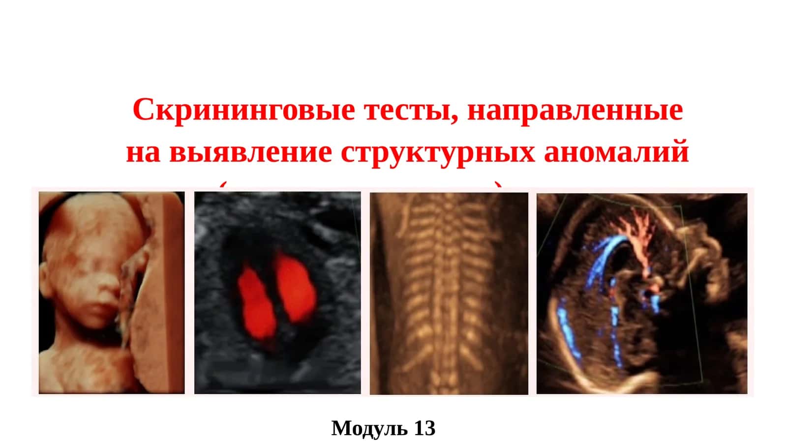 Скрининговые тесты, направленные на выявление структурных аномалий (пороков развития) плода
