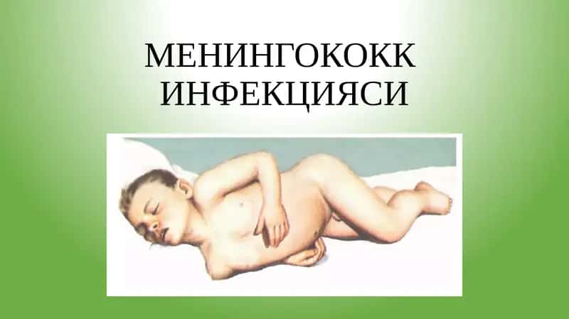 МЕНИНГОКОКК ИНФЕКЦИЯСИ