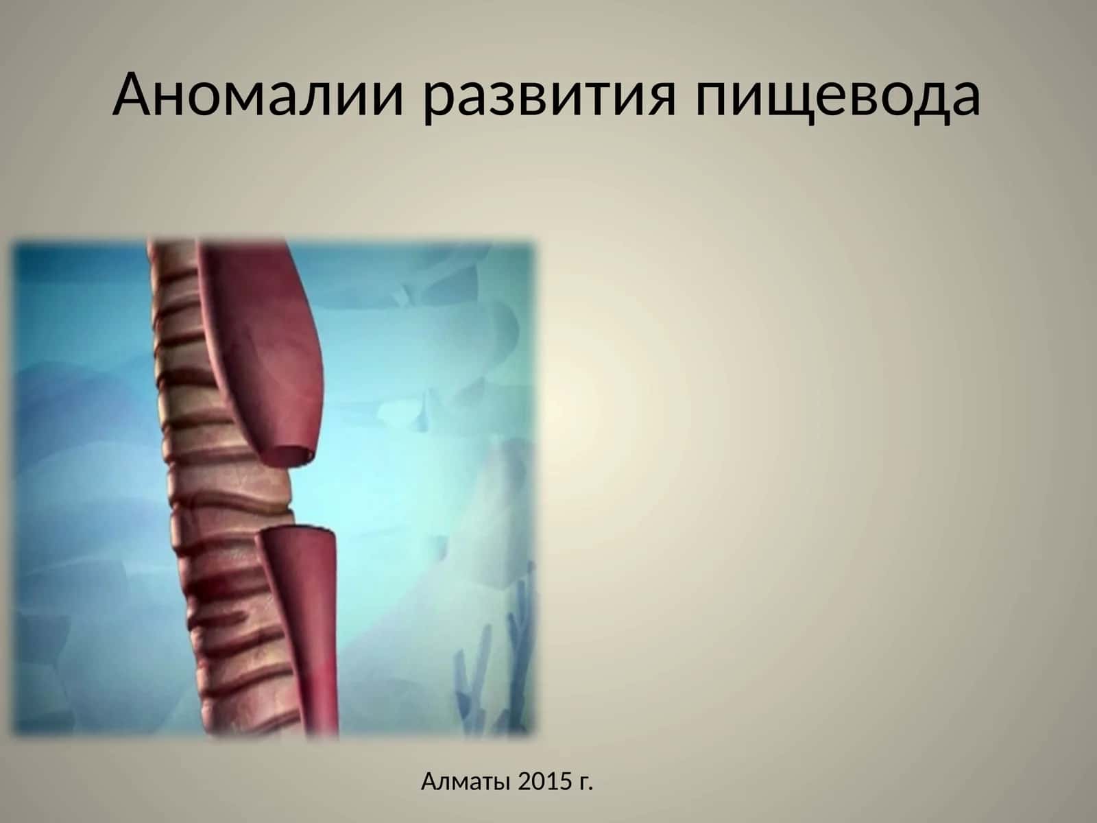 Аномалии развития пищевода