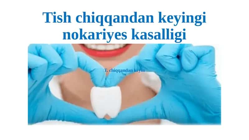 Tish chiqqandan keyingi nokariyes kasalligi