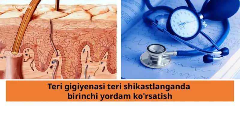 Teri gigiyenasi teri shikastlanganda birinchi yordam