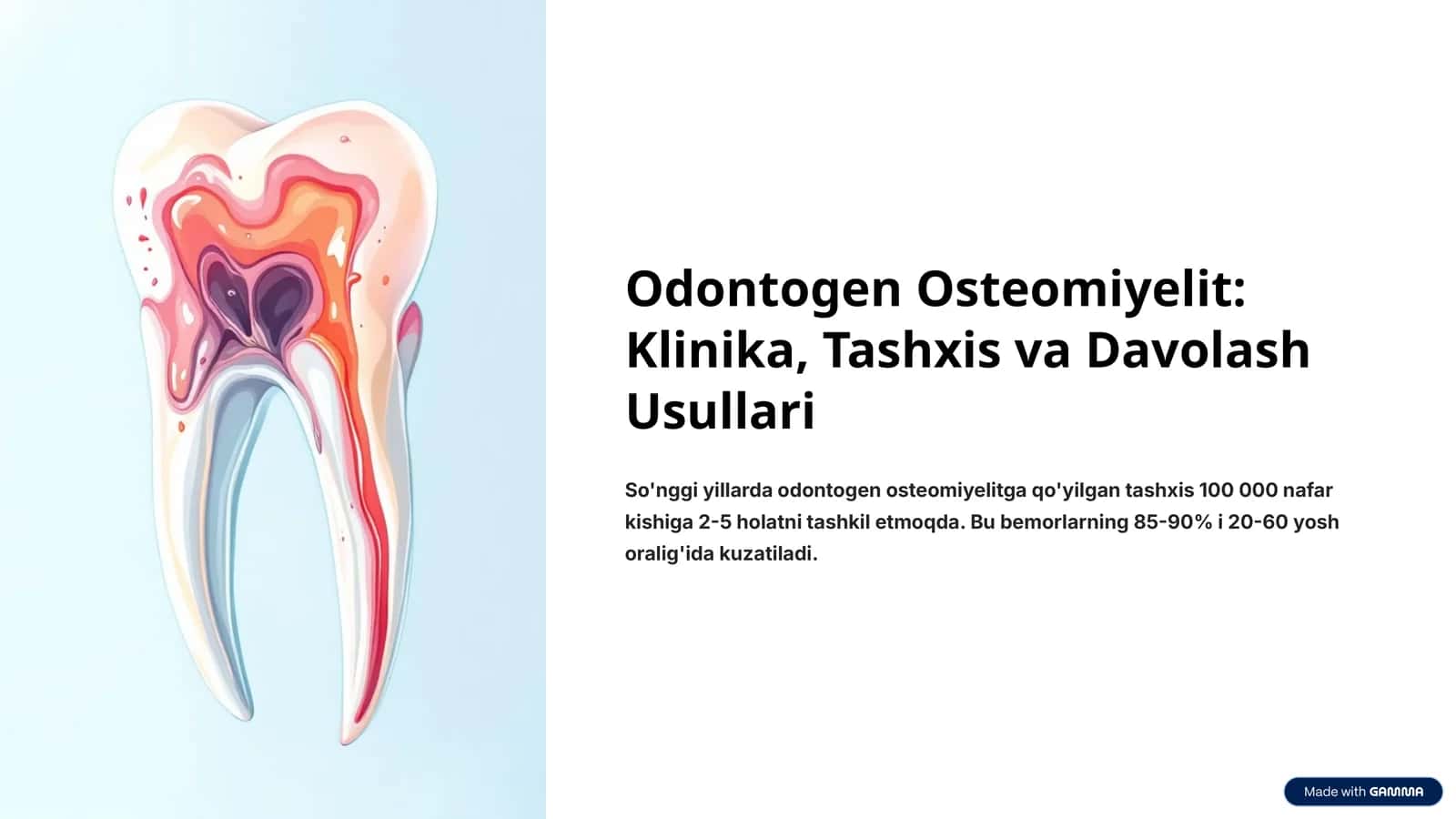 Odontogen Osteomiyelit: Klinika, Tashxis va Davolash Usullari