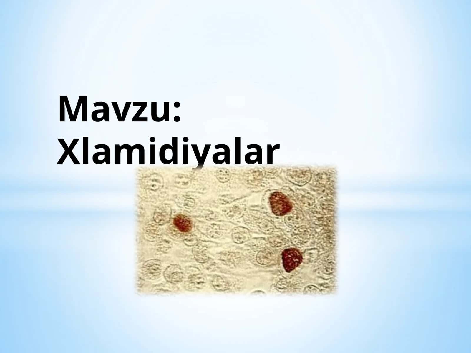 Xlamidiyalar