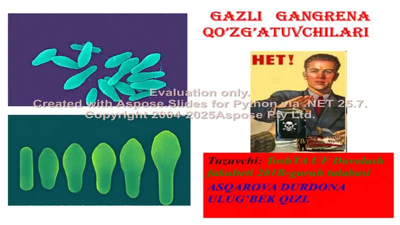 Gazli gangrena qo’zg’atuvchilari