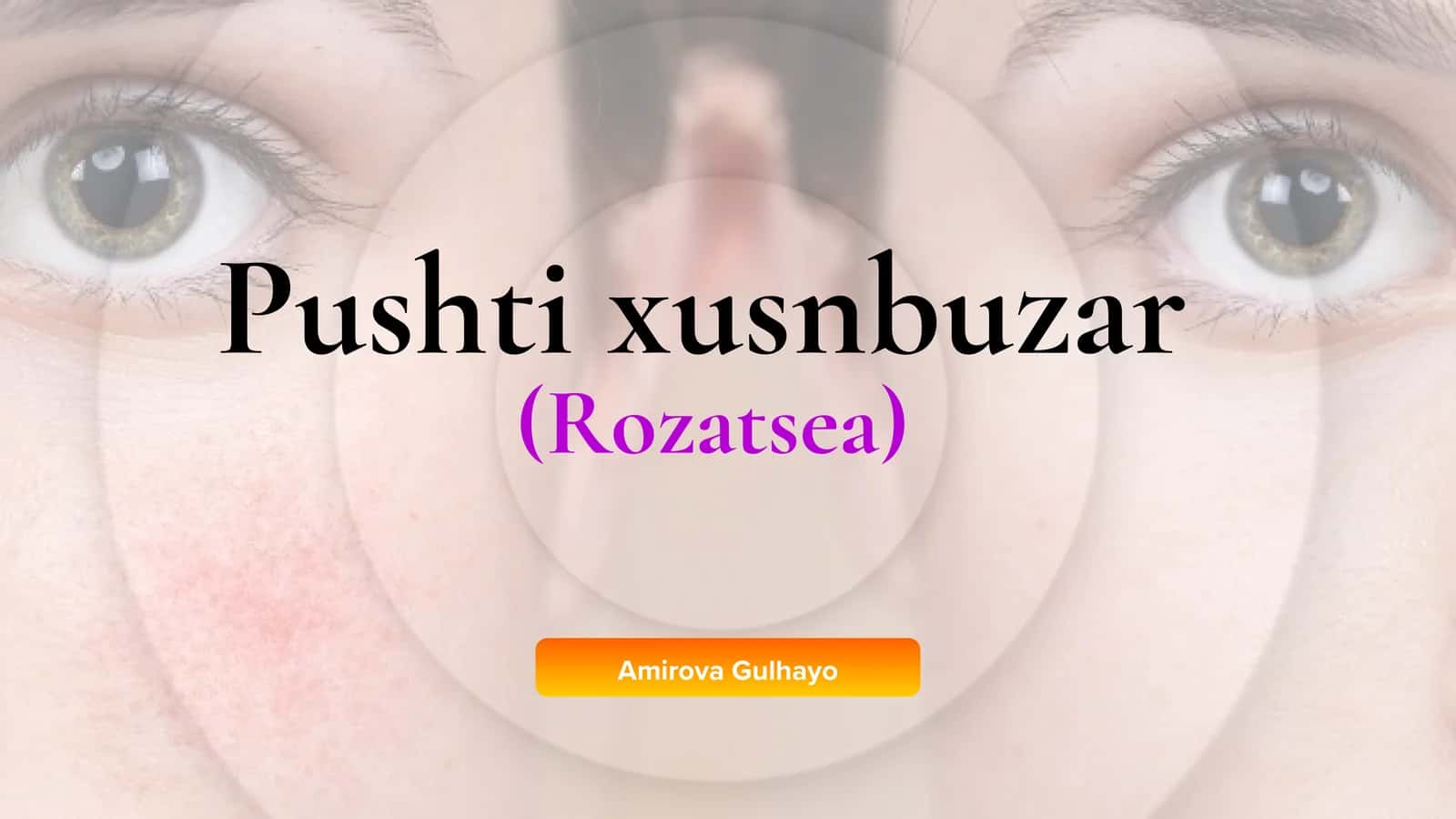 Pushti xusnbuzar (Rozatsea)