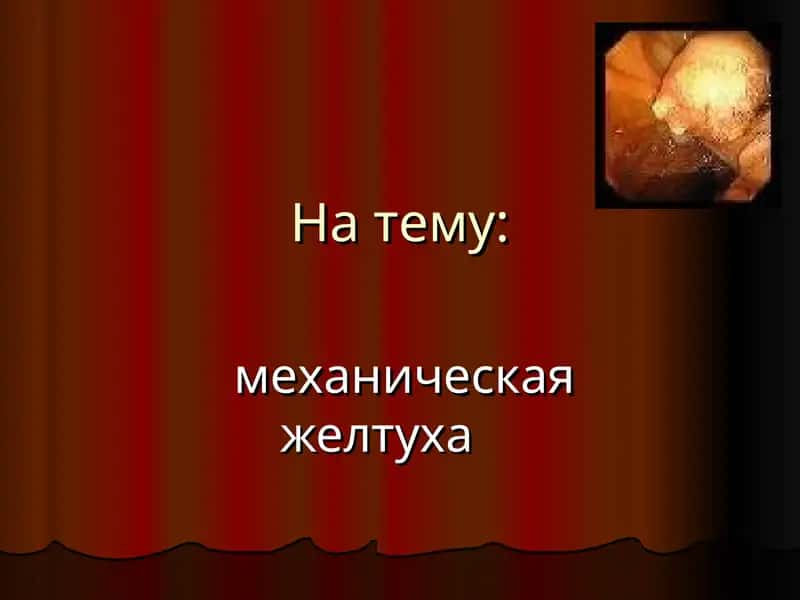 Механическая желтуха