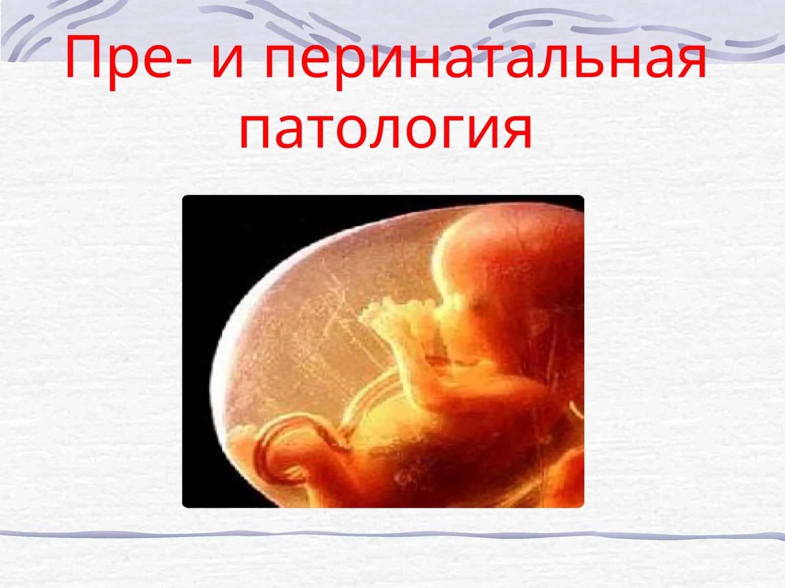 Пре- и перинатальная патология