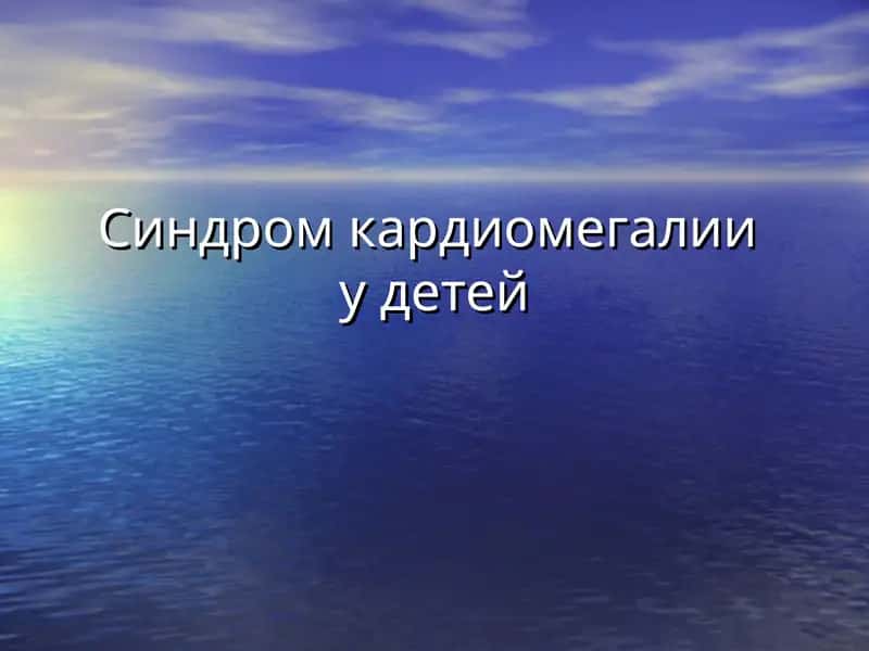 Кардиомегалия