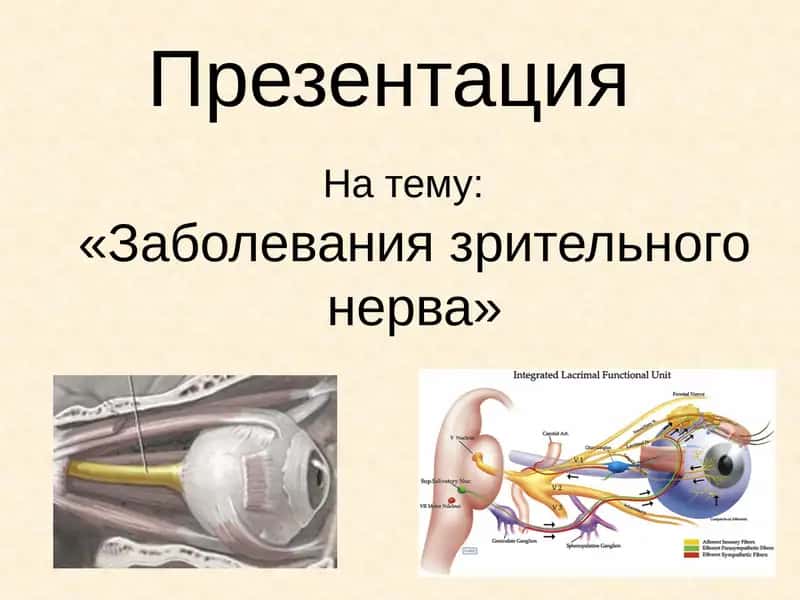 Заболевания зрительного нерва