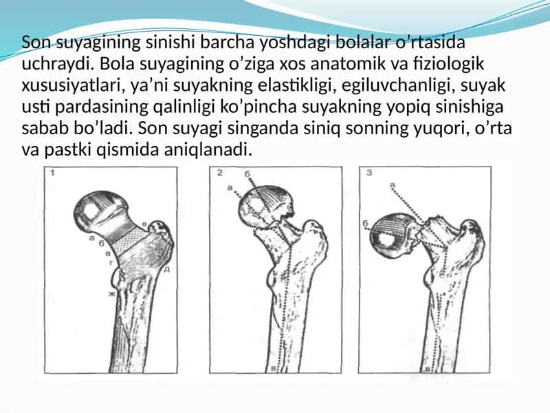 Sonsuyagining sinishlari
