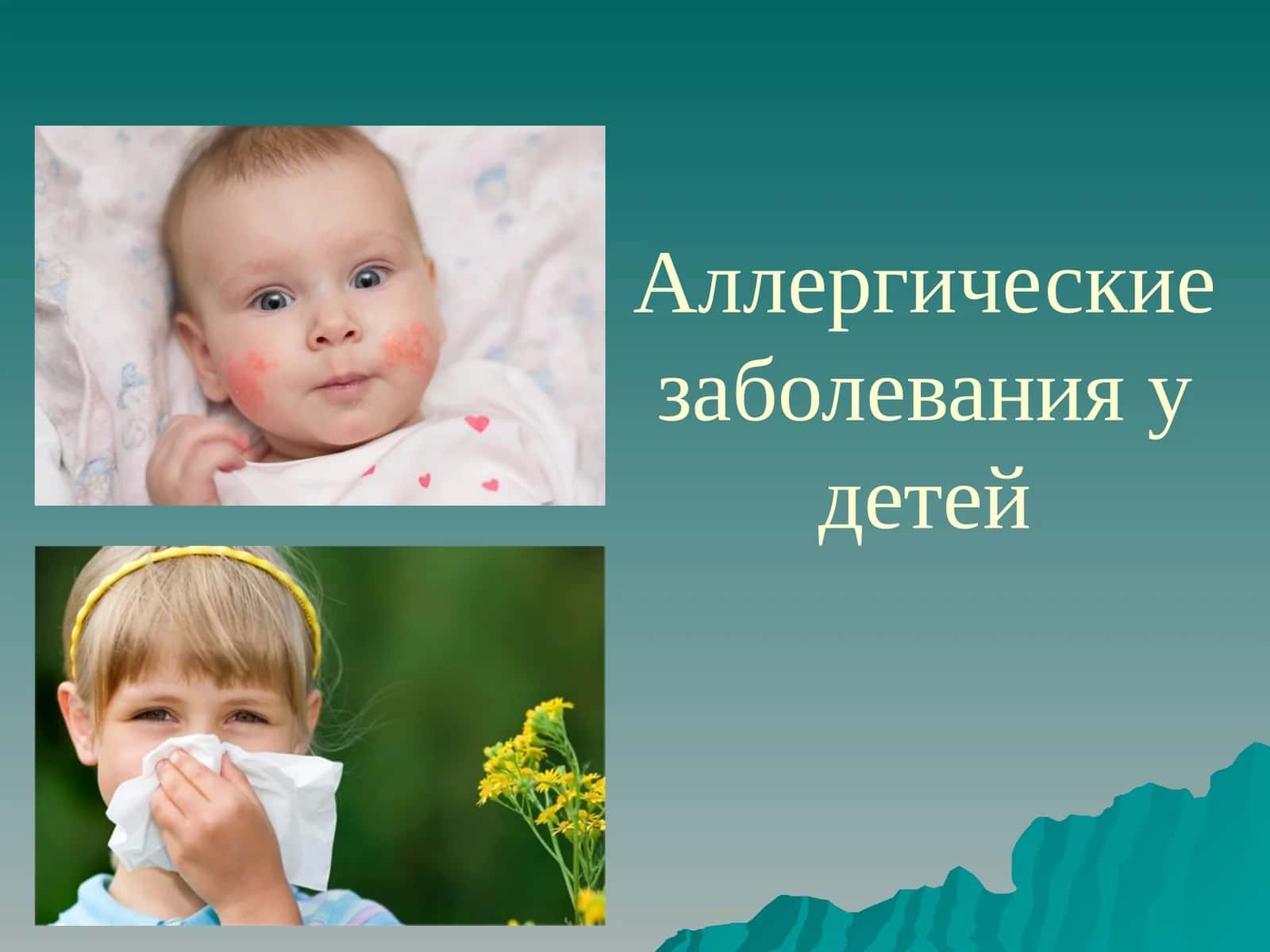 Аллергические заболевания у детей