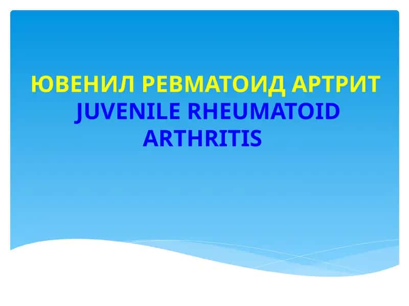 ЮВЕНИЛ РЕВМАТОИД АРТРИТ